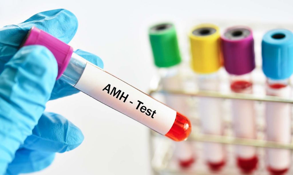 exame de hormônio antimulleriano para diagnóstico de infertilidade