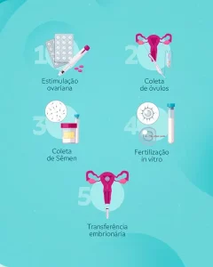 etapas da fertilização in vitro