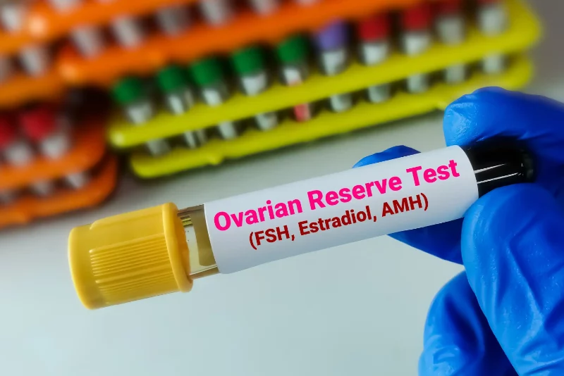exames para medir a baixa reserva ovariana 