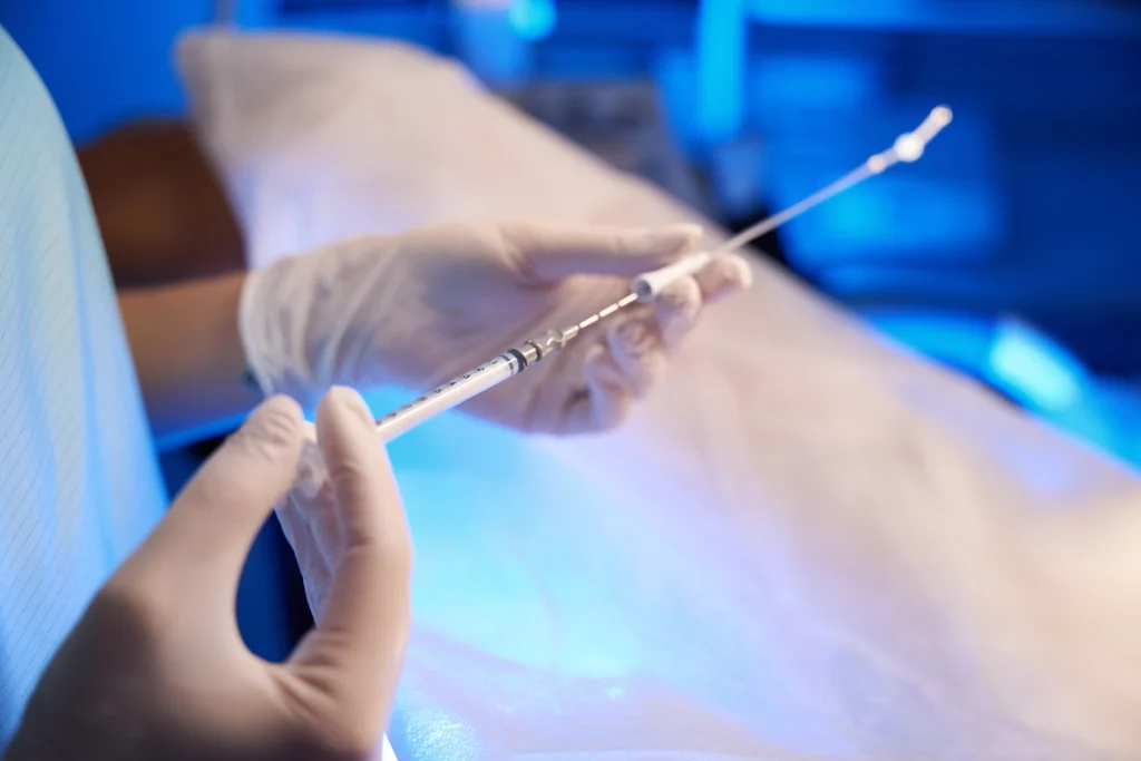 Mãos enluvadas segurando uma seringa e um cateter, simbolizando os procedimentos médicos necessários durante a inseminação artificial com sêmen de doador.